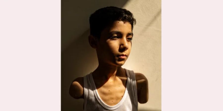 Fotografia de menino palestiniano mutilado vence World Press Photo 2025